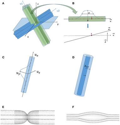 Improving the Realism of White Matter Numerical Phantoms: A Step toward a Better Understanding of the Influence of Structural Disorders in Diffusion MRI